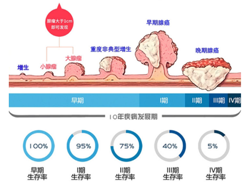直肠癌早筛试剂盒“第一证”—足不出户而明察秋毫