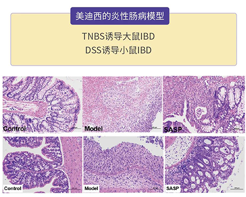 k8凯发国际的炎症性肠病模型