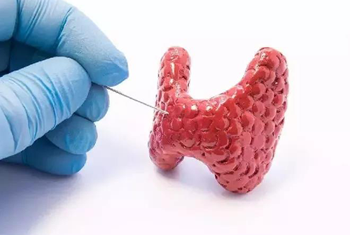 甲状腺疾病，包括甲状腺功能减退和甲状腺功能亢进，自古以来就是反复被医学研究人员研究的疾病