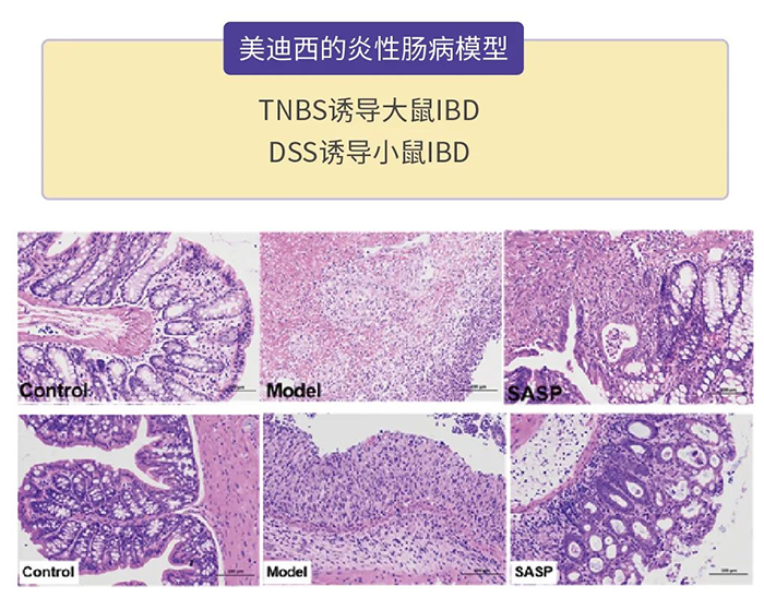 k8凯发国际的炎性肠病模型.png k8凯发国际的炎性肠病模型.png